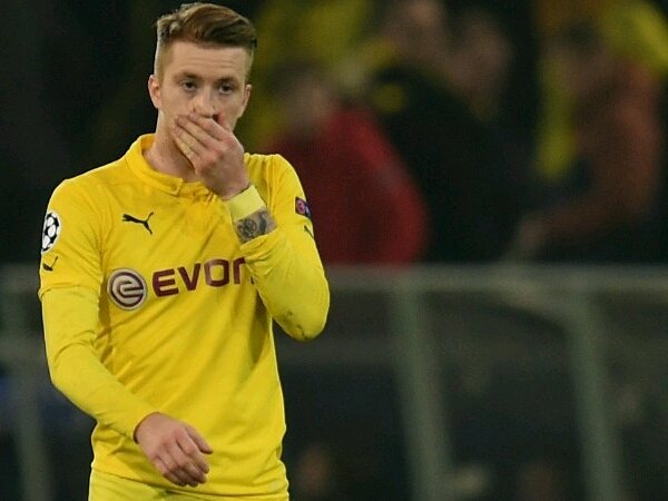 Borussia Dortmund: Marco Reus Kembali Alami Cedera