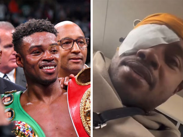 Errol Spence memberitahukan operasi katarak yang dijalaninya melalui media sosial. (Foto: Instagram)