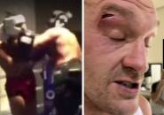 Tyson Fury Terluka Saat Latihan; Duel 17 Februari Vs Oleksandr Usyk Ditunda