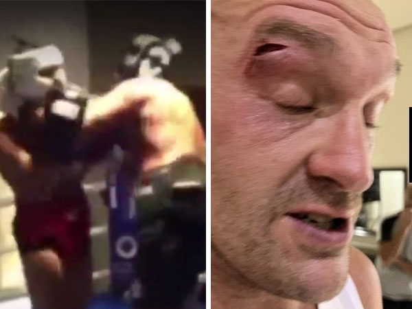 Pertarungan pada 17 Februari antara Tyson Fury vs Oleksandr Usyk ditunda akibat Fury mengalami luka di matanya saat latihan. (Foto: X.com)