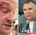 Tyson Fury Serang Manajer Oleksandr Usyk: "Jangan Panggil Saya Pengecut!"